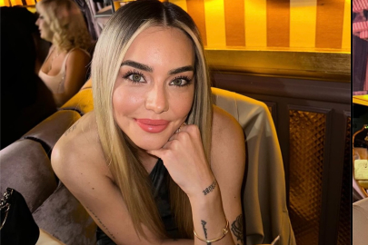 Survivor Aycan Yanaç’ın son halini gören inanamıyor! Dizi teklifleri yağıyormuş