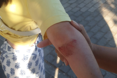 Sokak köpekleri kız çocuğuna saldırdı