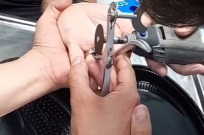 Yalova İtfaiyesinden soluk kesen yüzük çıkarma operasyonu