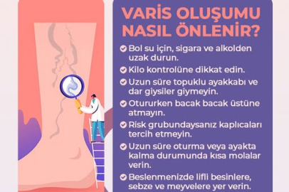 Yalova İl Sağlık Müdürlüğü’nden varis hastalığına karşı uyarı