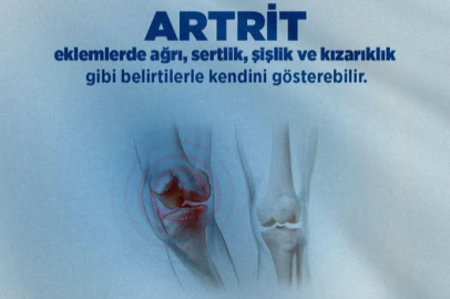 Yalova İl Sağlık Müdürlüğü’nden artrit farkındalığı çağrısı