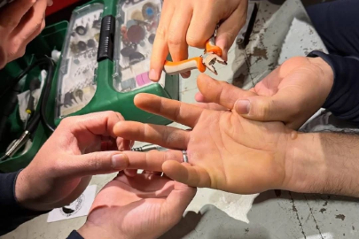 Yalova’da gece yarısı yüzük çıkarma operasyonu