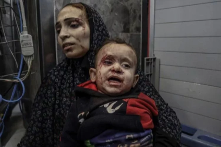 İsrail, hastane bombaladı: 850 can kaybı!